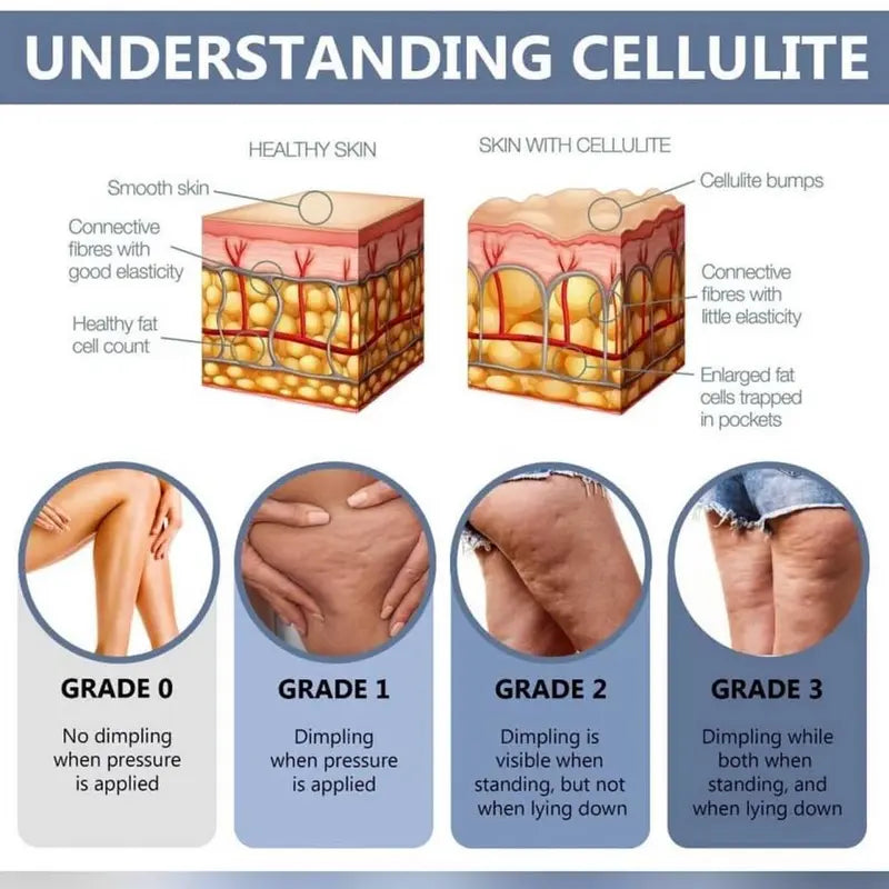 Anti-cellulite body balm slimming lotion Effect on the skin