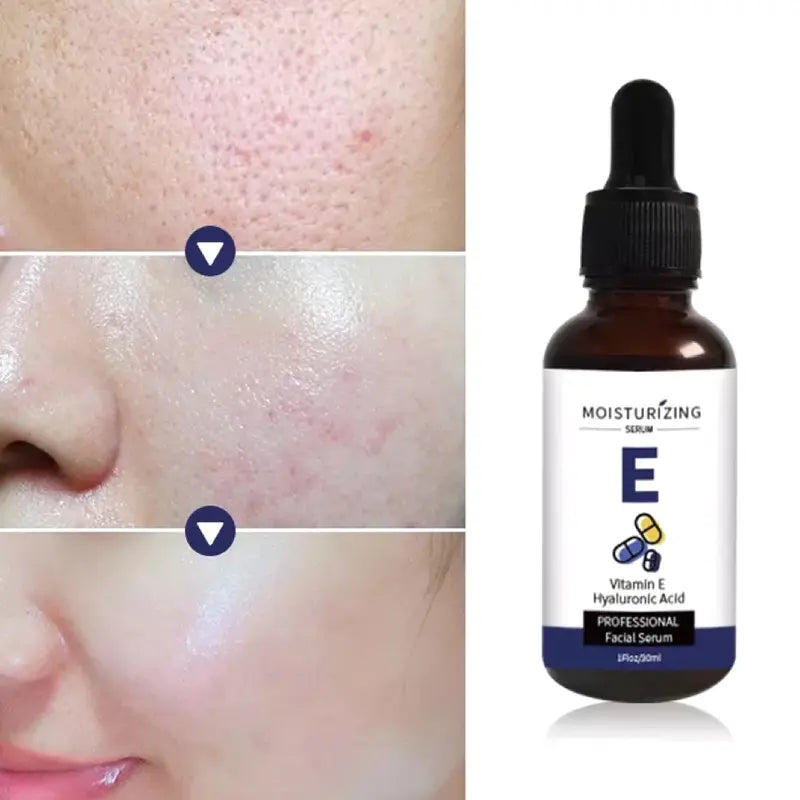 Calming Face Serum Vitamin E, Hyaluronic Acid & Antioxidants Moisturizing & Anti-Aging