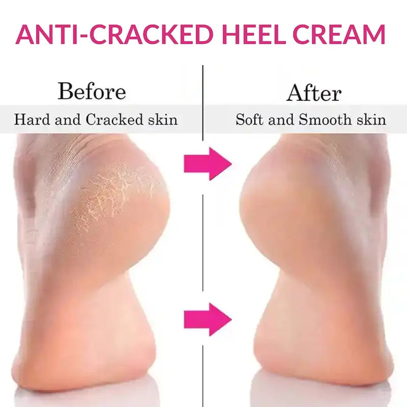 Intensive Repair Foot Cream Cracked Heel Treatment with Lavender & Lanolin