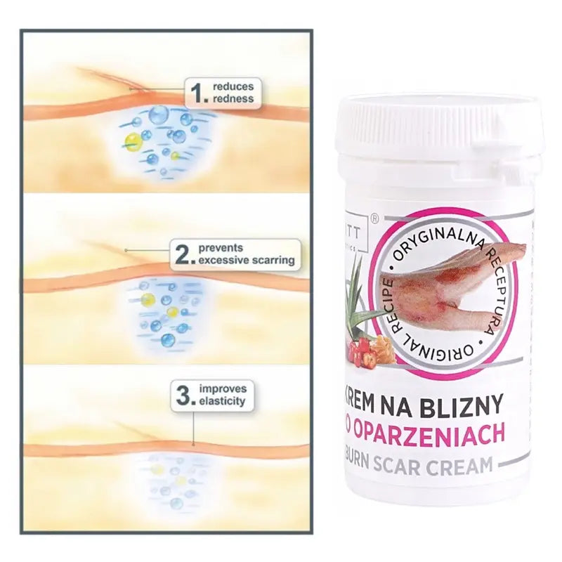 Intensive Regenerating Scar Cream Onion Extract Acerola Aloe Vera Lanolin & Shea Butter