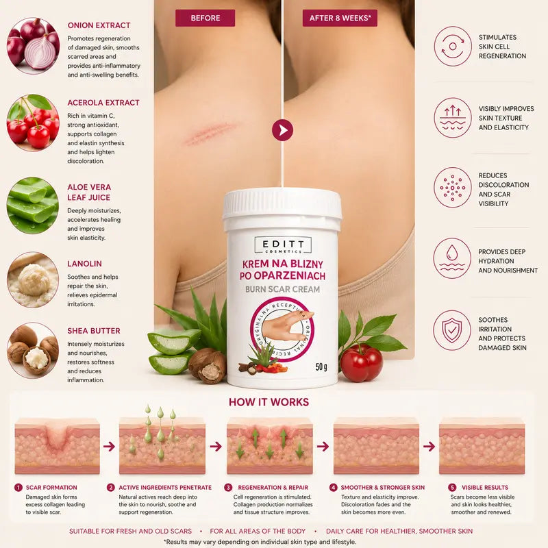 Burn Scar Cream - Intensive Regenerating Scar Cream with Onion Extract Acerola Aloe Vera Lanolin & Shea Butter