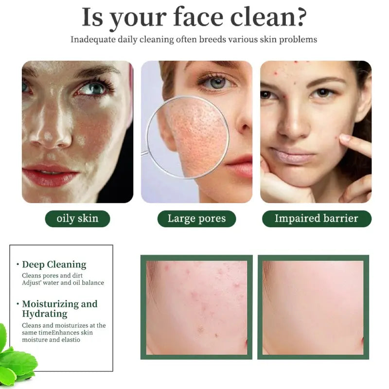 Face Mask Stick Green Tea & Clay Purifying Anti-Acne & Oil Control Deep Pore Treatment