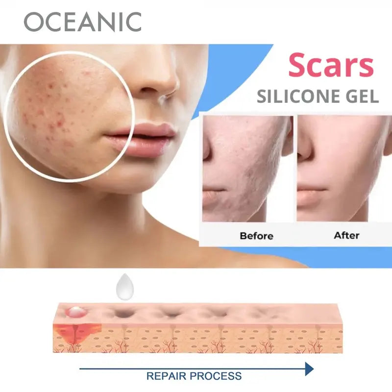 Silicone Scar Gel Stretch Mark & Scar Care Onion & Bearberry Hypoallergenic & Fragrance-Free