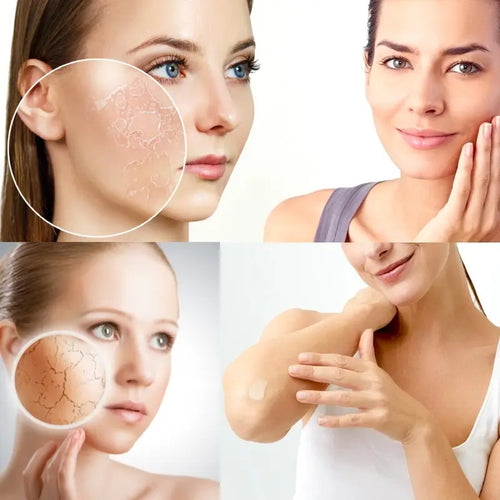 Vitamin A retinol ointment cream maść z witaminą A