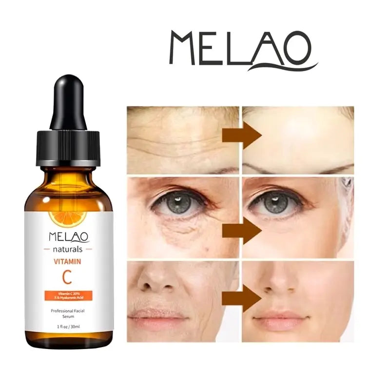 Vitamin C 20% Serum with Hyaluronic Acid & Vitamin E – Anti-Aging Brightening Face Serum 30ml
