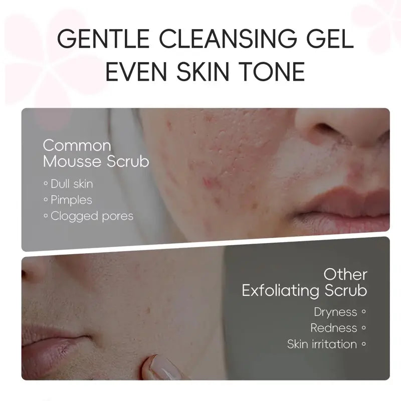 Japan Sakura Peeling Gel – Gentle Exfoliating Face & Body Scrub Hyaluronic Acid, Vitamin C & Sakura Extract